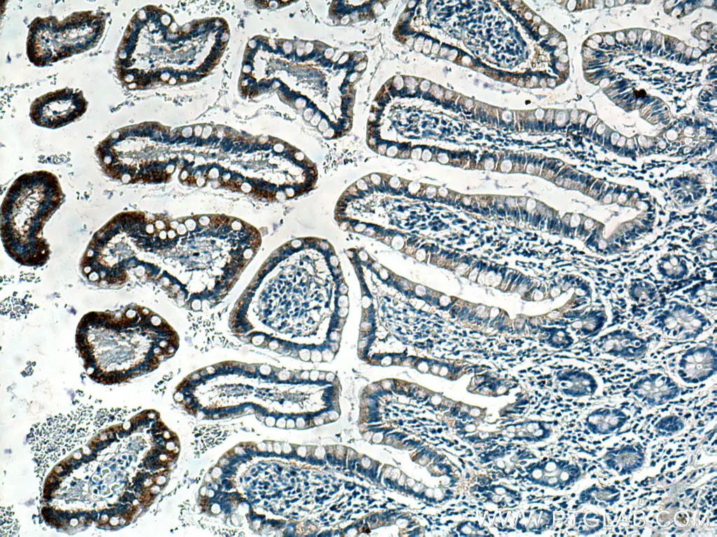 NOTUM antibody (66956-1-Ig) | Proteintech