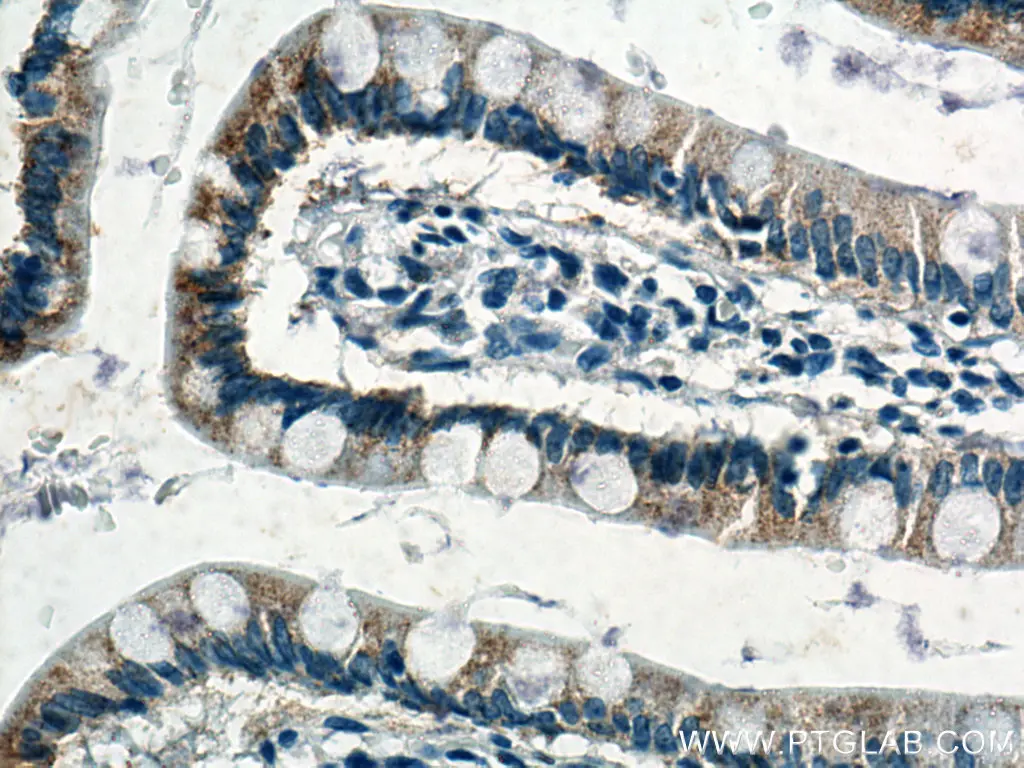 NOTUM antibody (66956-1-Ig) | Proteintech