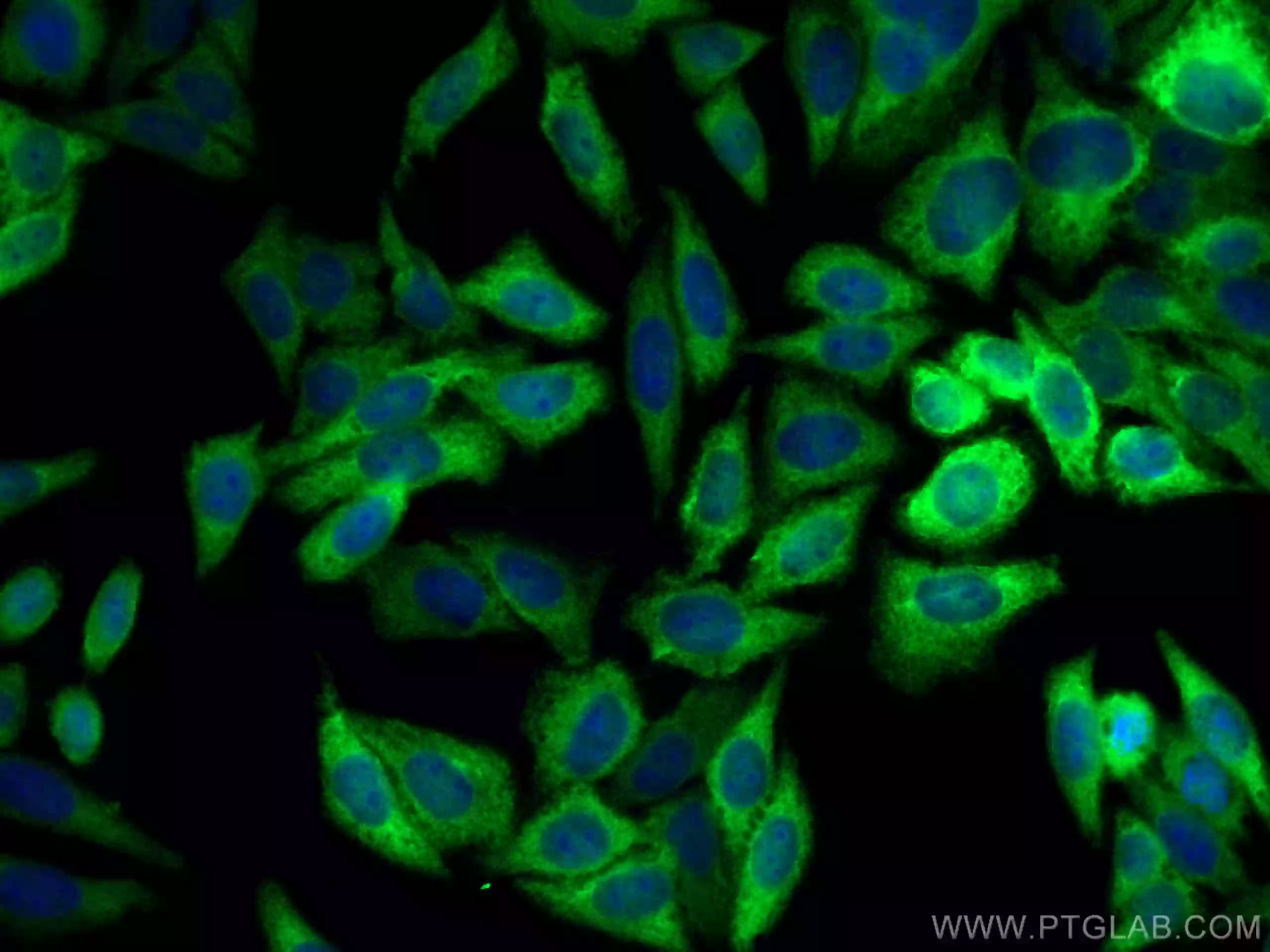 NQO1 antibody (11451-1-AP) | Proteintech