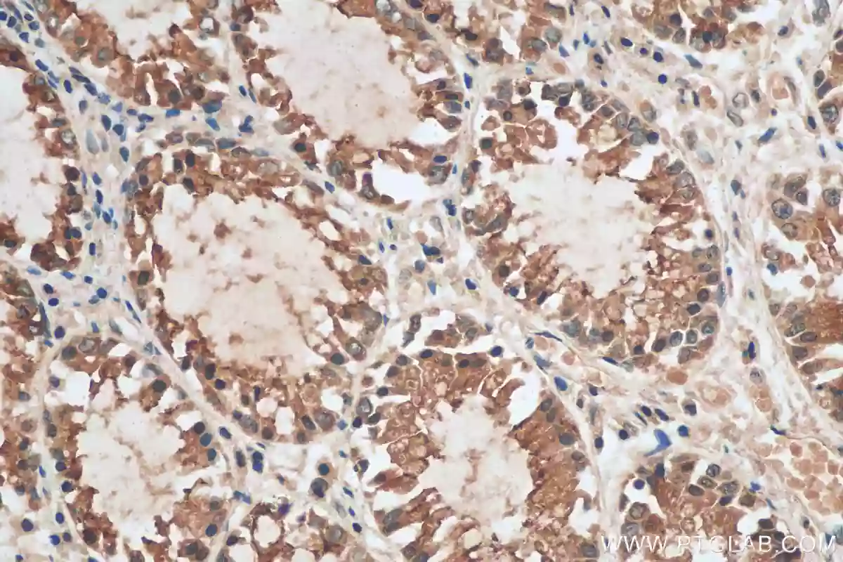 NQO1 antibody (11451-1-AP) | Proteintech