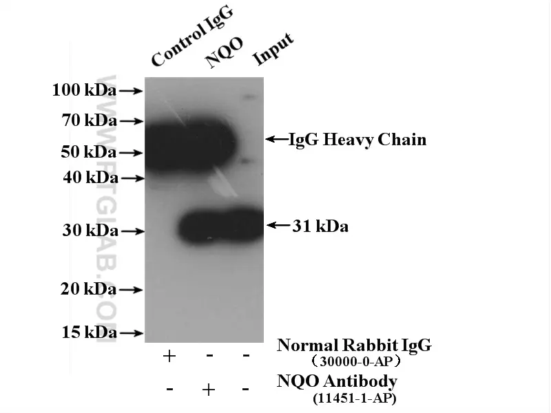 NQO1 antibody (11451-1-AP) | Proteintech