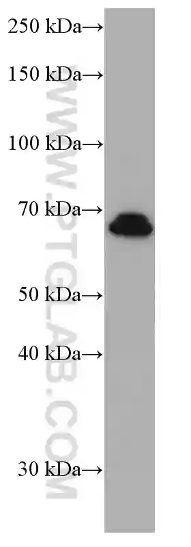 Nurr1/NR4A2 antibody (66878-1-Ig) | Proteintech