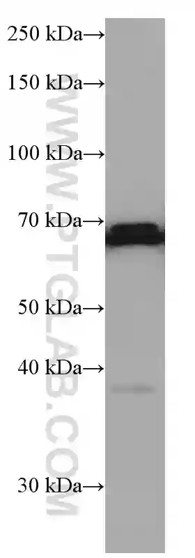 Nurr1/NR4A2 antibody (66878-1-Ig) | Proteintech