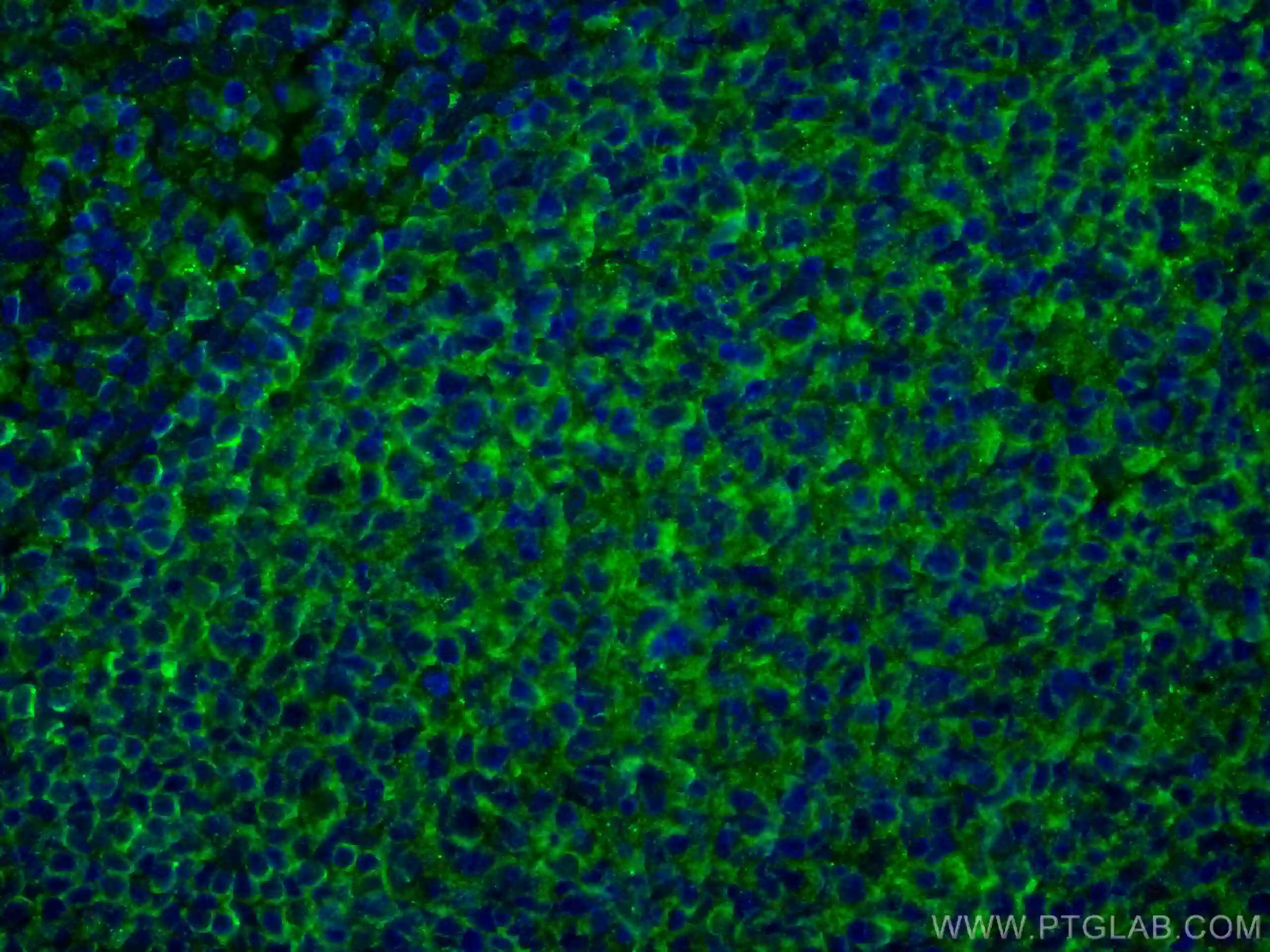 NT5E,CD73 antibody (67789-1-Ig) | Proteintech