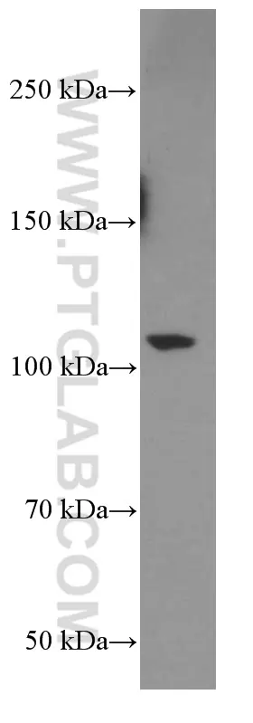 TrkC antibody (66380-1-Ig) | Proteintech