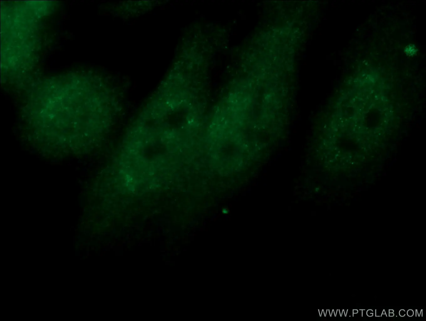 NXF1 antibody (10328-1-AP)