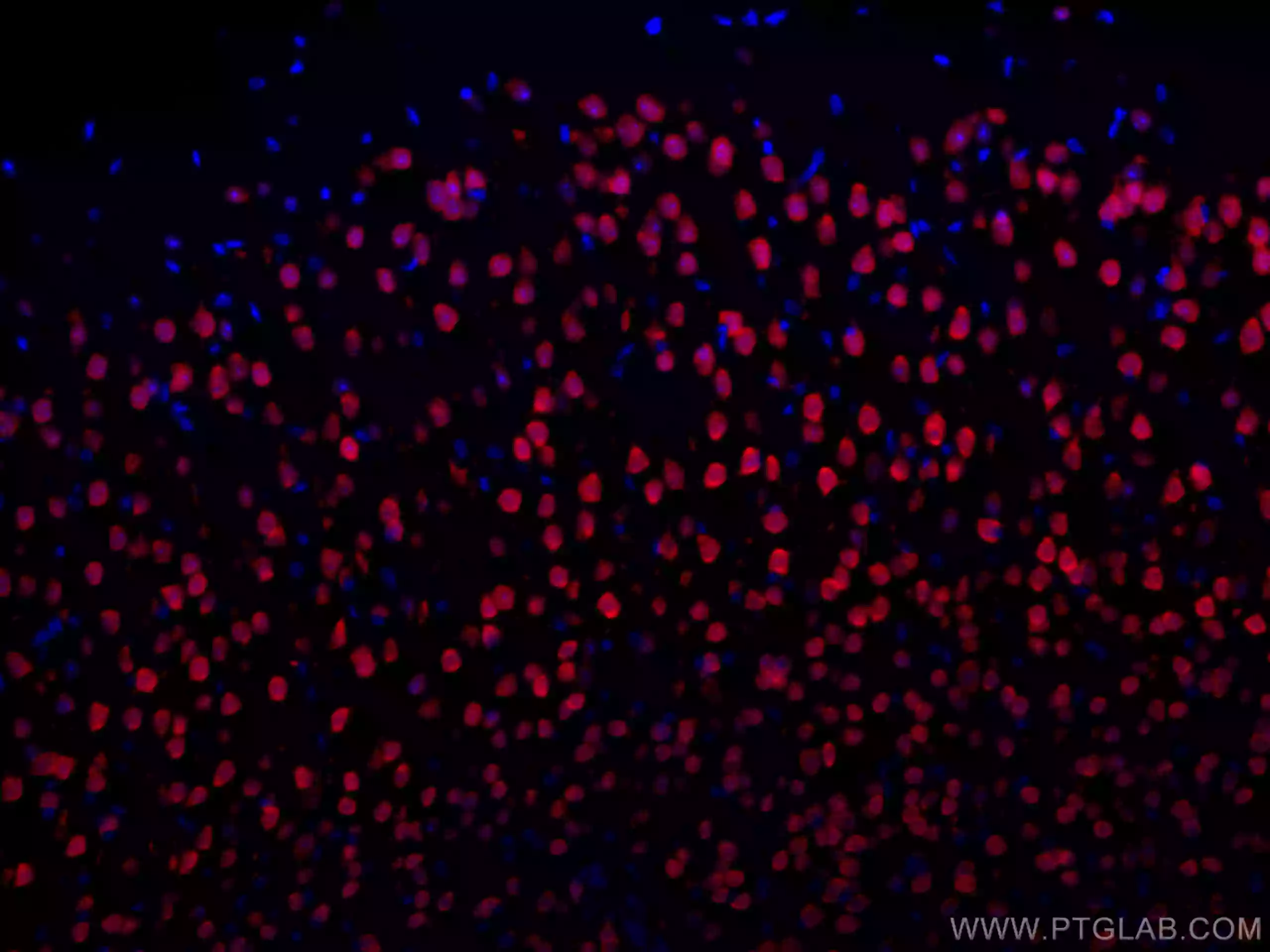 NeuN antibody (CL594-26975) | Proteintech