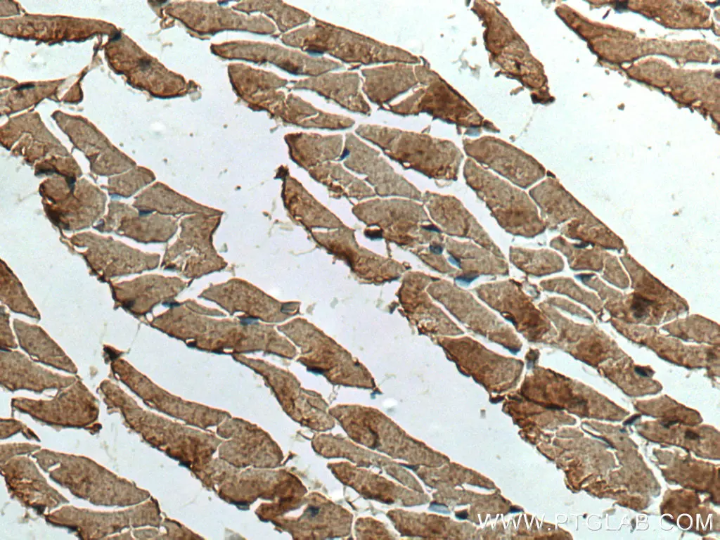 Ninein antibody (67132-1-Ig) | Proteintech