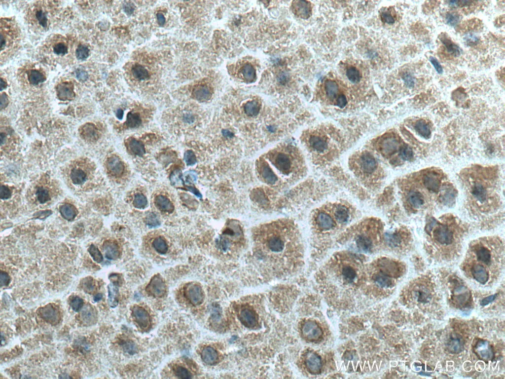 Ninein antibody (67132-1-Ig) | Proteintech