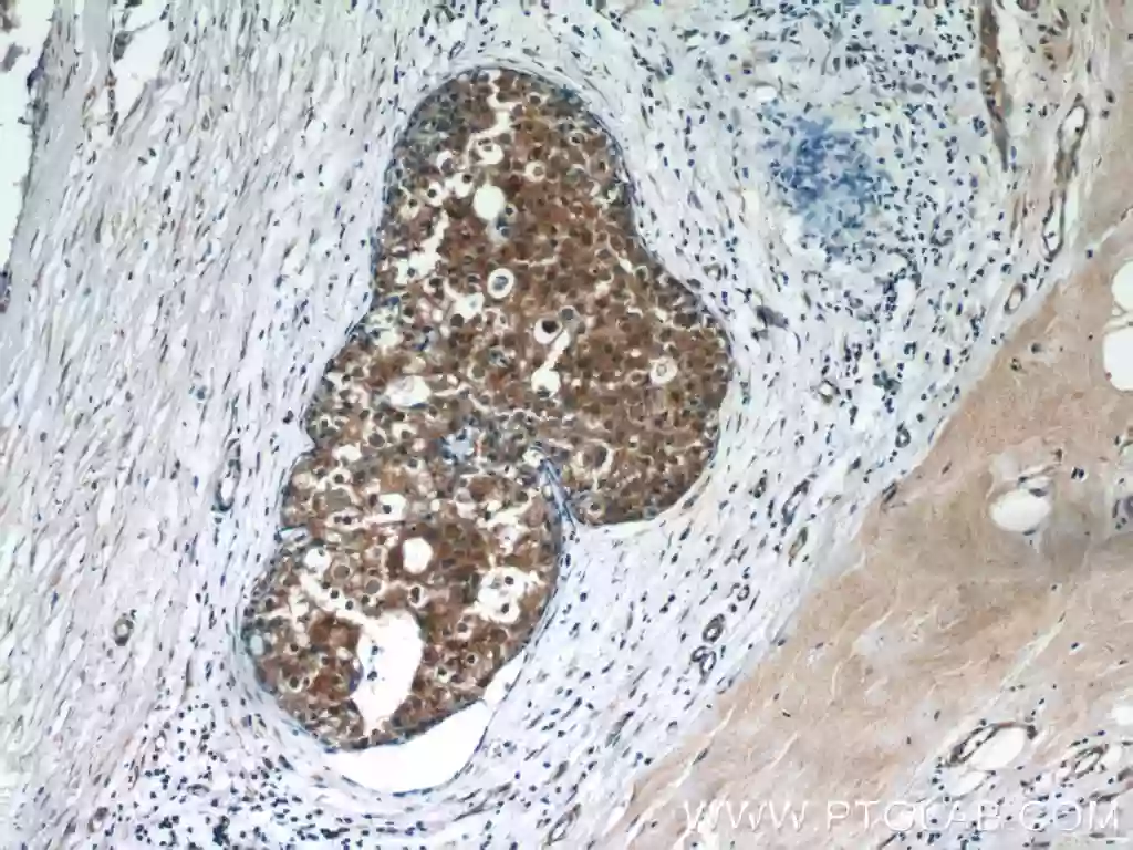 OAS2 antibody (19279-1-AP) | Proteintech