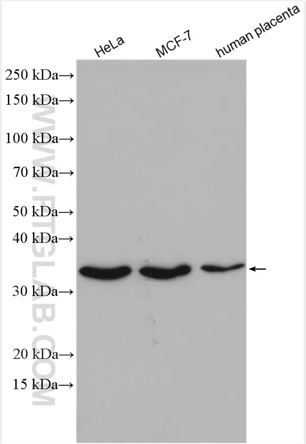 OCIAD1 antibody (16634-1-AP) | Proteintech
