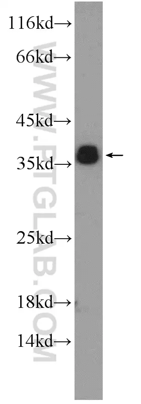 ORAI2 antibody (20592-1-AP) | Proteintech