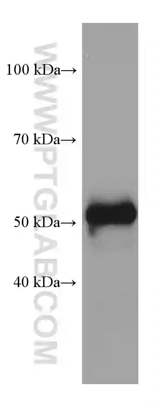 OXCT1 antibody (67836-1-Ig) | Proteintech