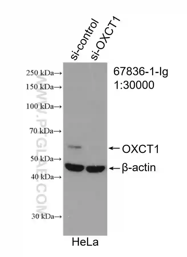OXCT1 antibody (67836-1-Ig) | Proteintech