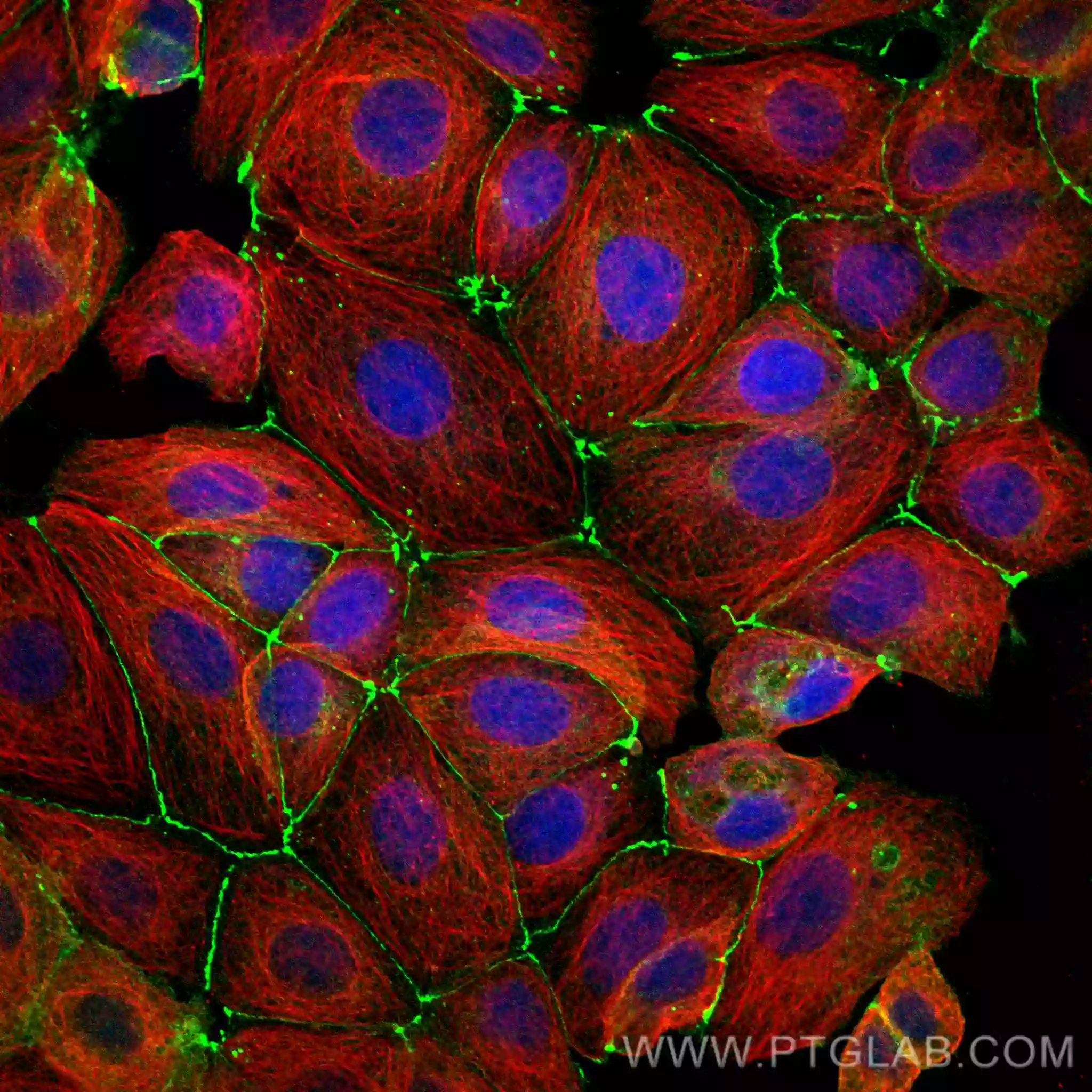 IF (immunofluorescence) staining of MCF-7 cells with Occludin recombinant antibody
