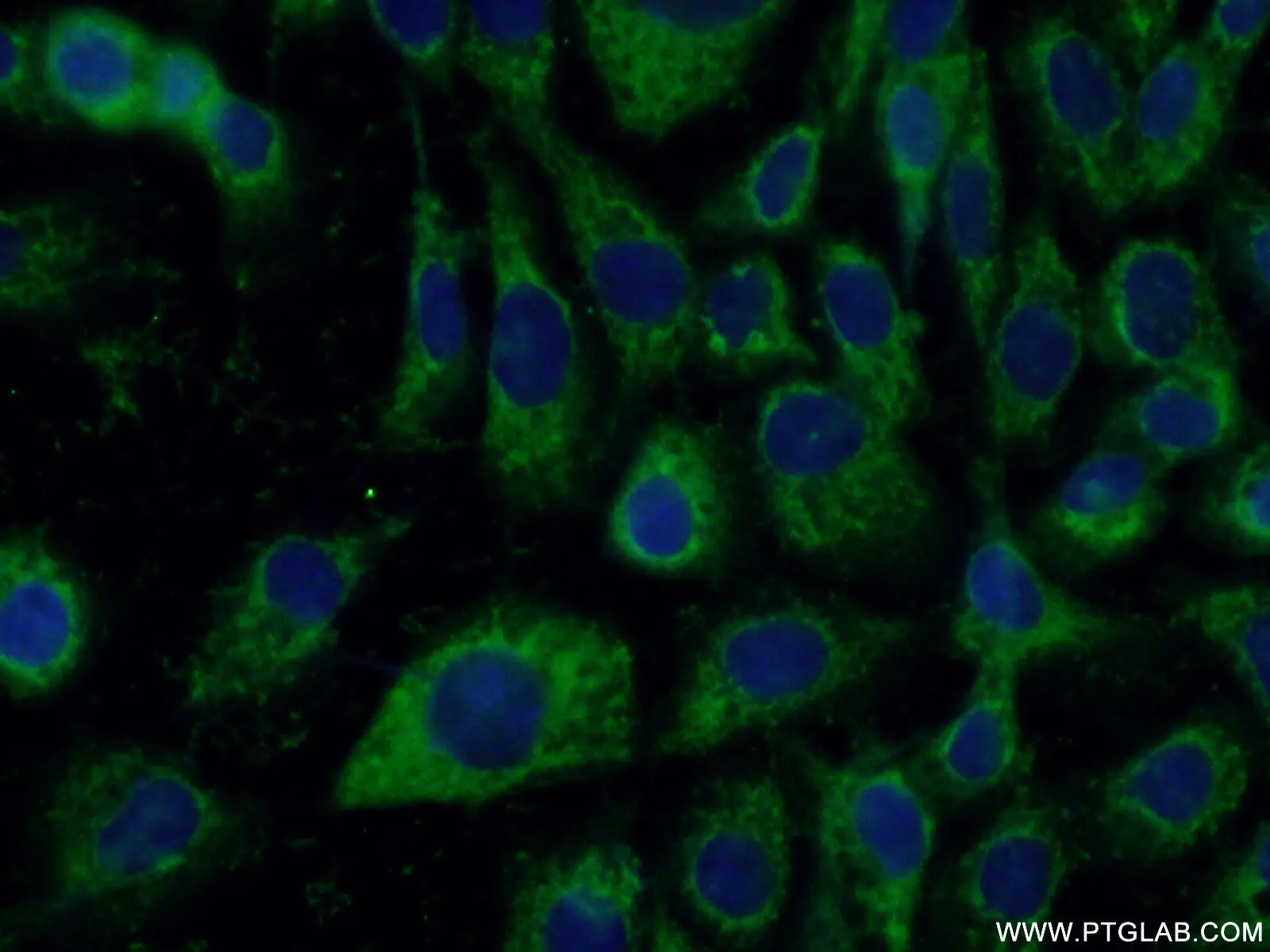 P4HA1 antibody (12658-1-AP) | Proteintech