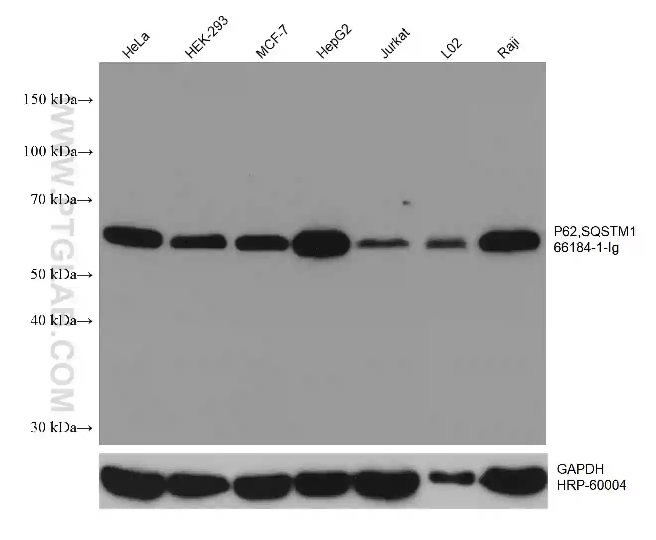 P62,SQSTM1 antibody (66184-1-Ig) | Proteintech
