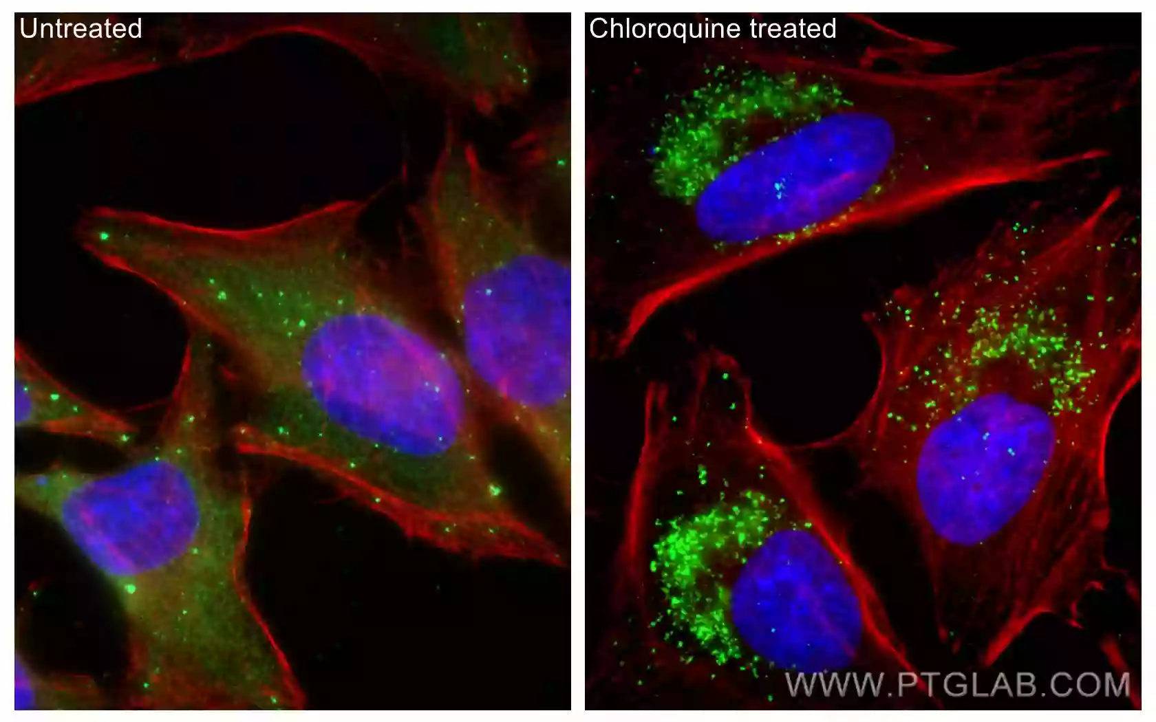 P62,SQSTM1 antibody (80294-1-RR) | Proteintech