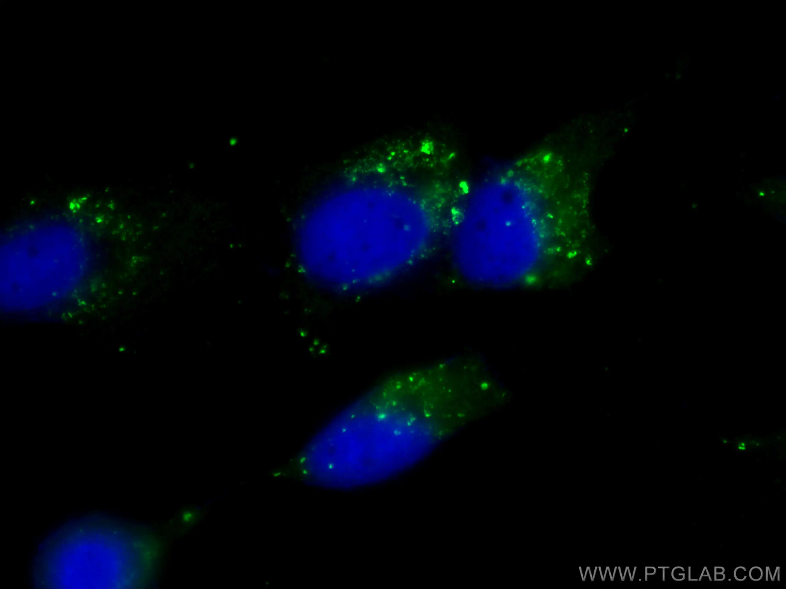 P62,SQSTM1 antibody (CL488-66184) | Proteintech