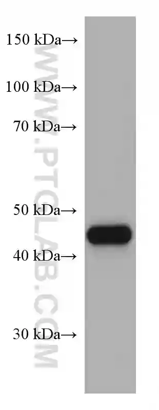 PAI-1 antibody (66261-1-Ig) | Proteintech