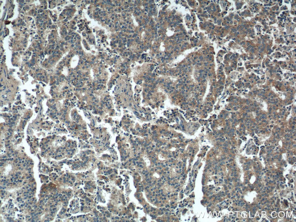 PARL antibody (26679-1-AP) | Proteintech