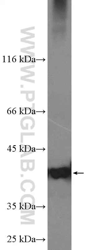 PARL antibody (26679-1-AP) | Proteintech