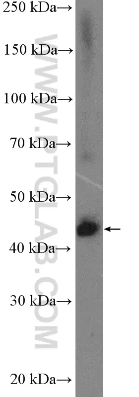 PARL antibody (26679-1-AP) | Proteintech