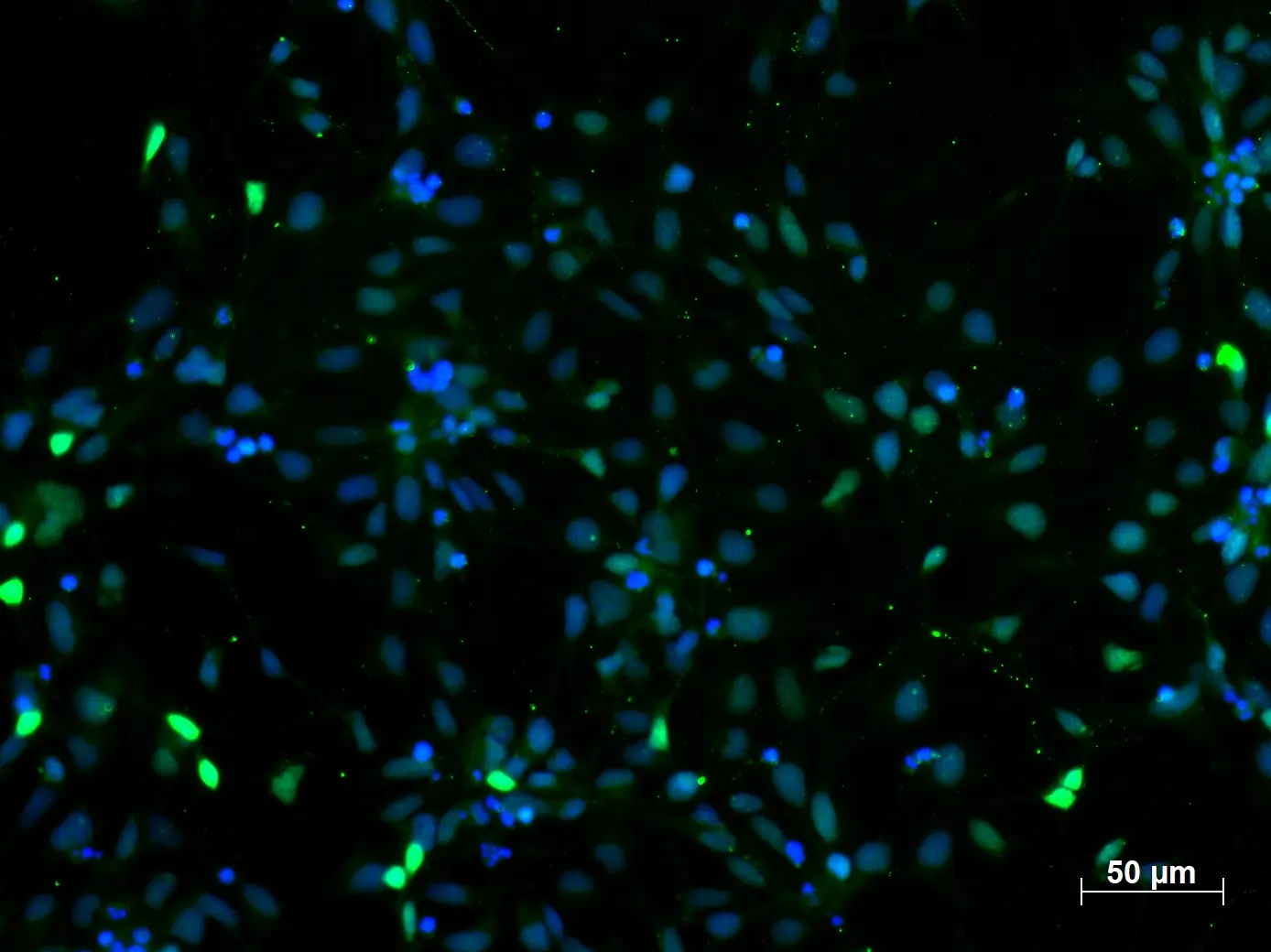 immunofluorescence (IF) staining of iPS cells using Proteintech PAX6 antibody (12323-1-AP)