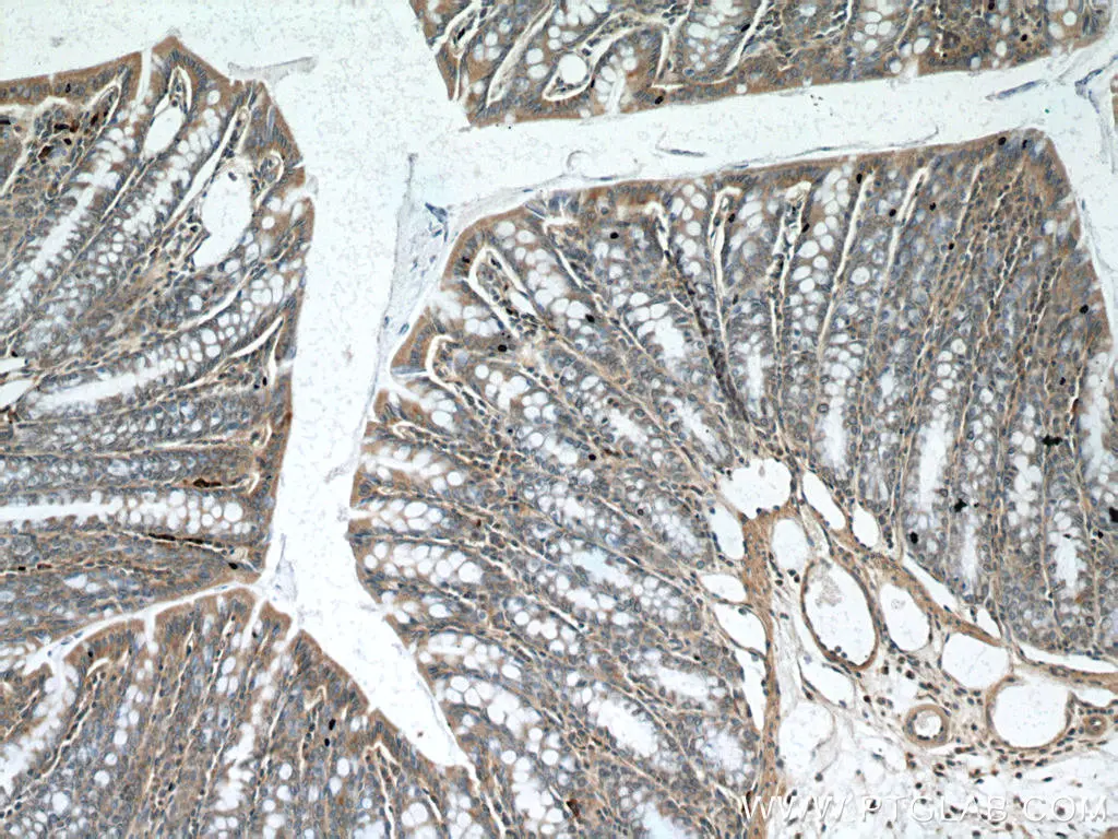 PDE4D antibody (12918-1-AP) | Proteintech