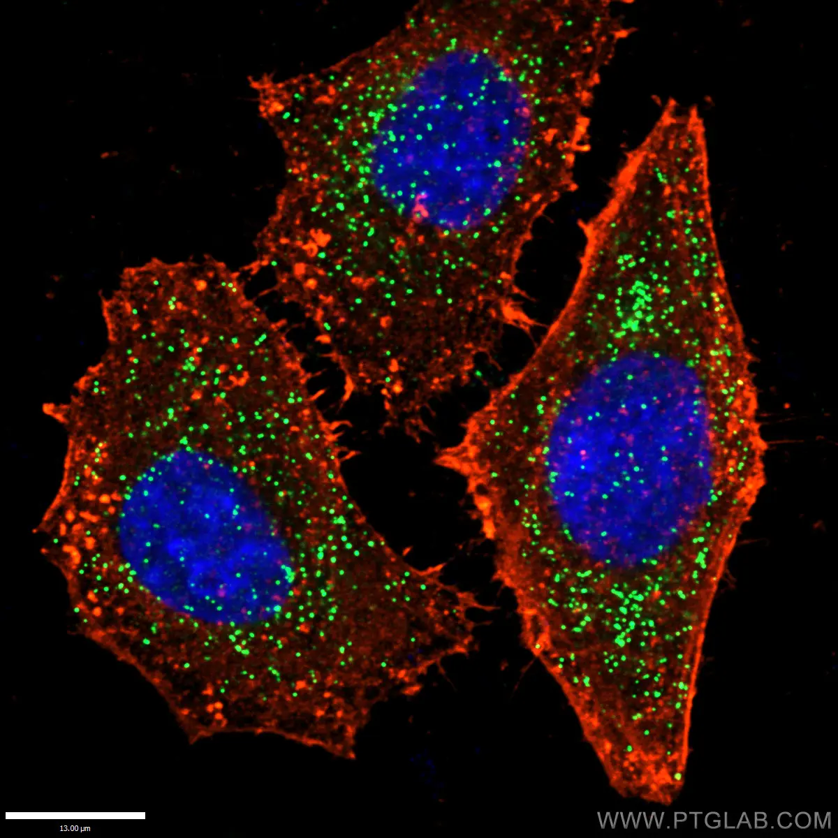 PEX14 antibody (10594-1-AP) | Proteintech