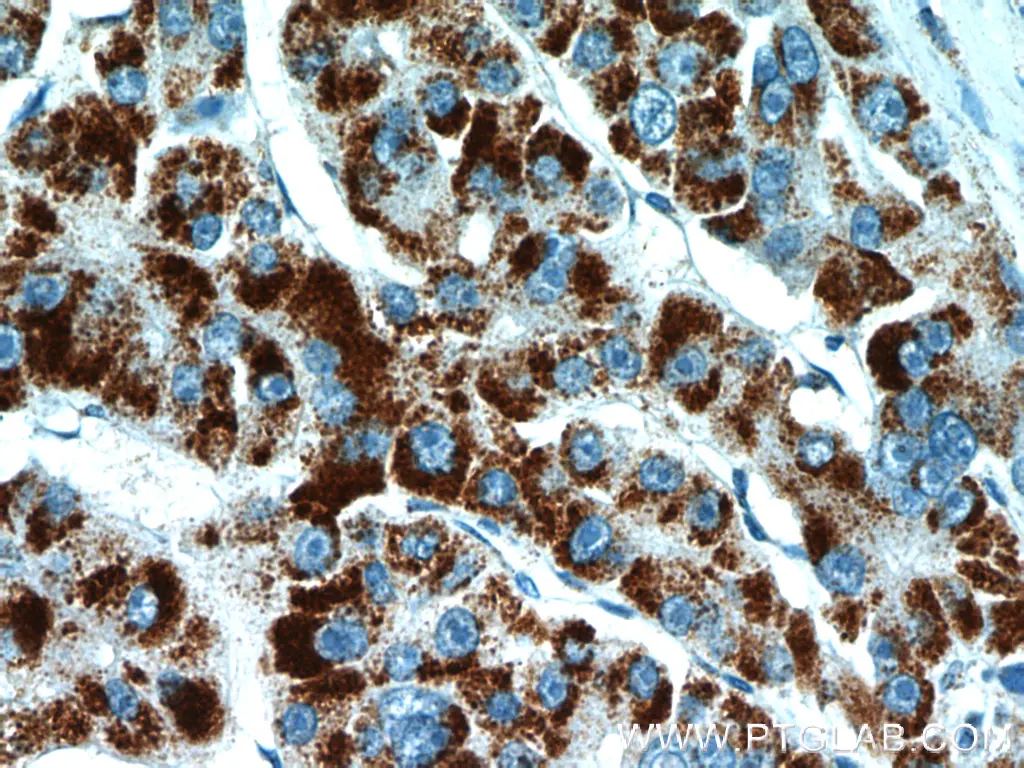 PEX14 antibody (10594-1-AP) | Proteintech