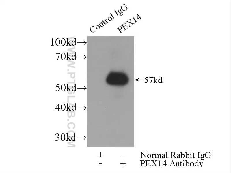 PEX14 antibody (10594-1-AP) | Proteintech