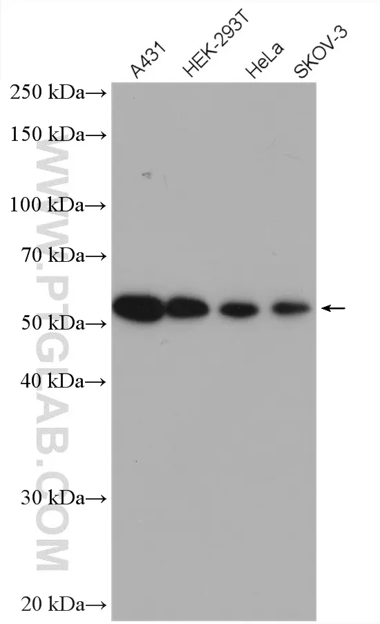 PEX14 antibody (10594-1-AP) | Proteintech