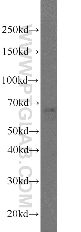 PEX5L antibody (13084-1-AP) | Proteintech