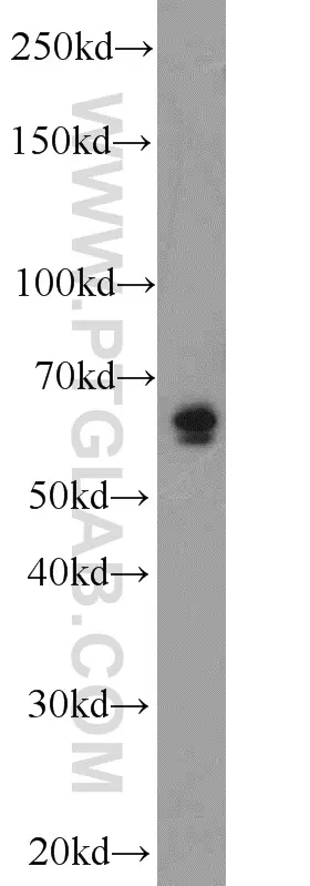 PEX5L antibody (13084-1-AP) | Proteintech