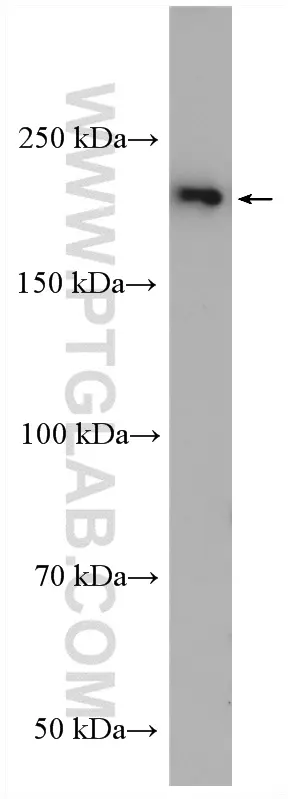 PI4KA antibody (12411-1-AP) | Proteintech