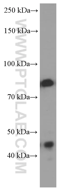 PI3 Kinase p85 Alpha antibody (60225-1-Ig) | Proteintech