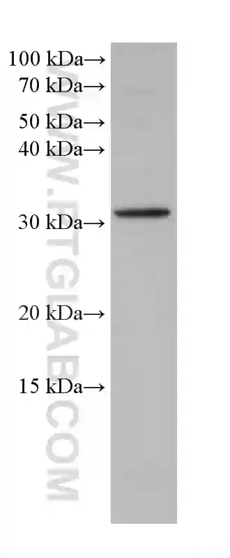 PITX2 antibody (67201-1-Ig)