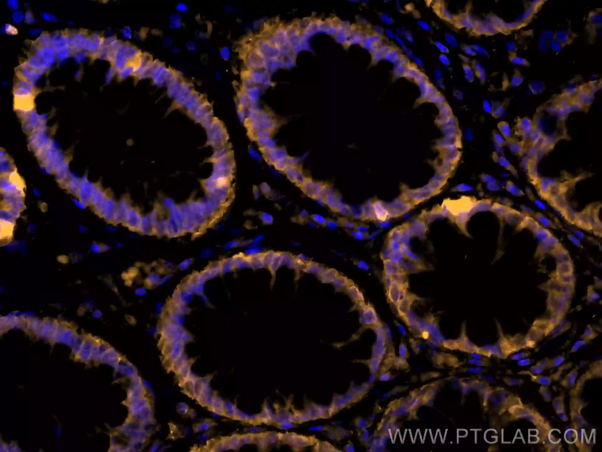 PPAR Gamma antibody (CL555-60127) | Proteintech