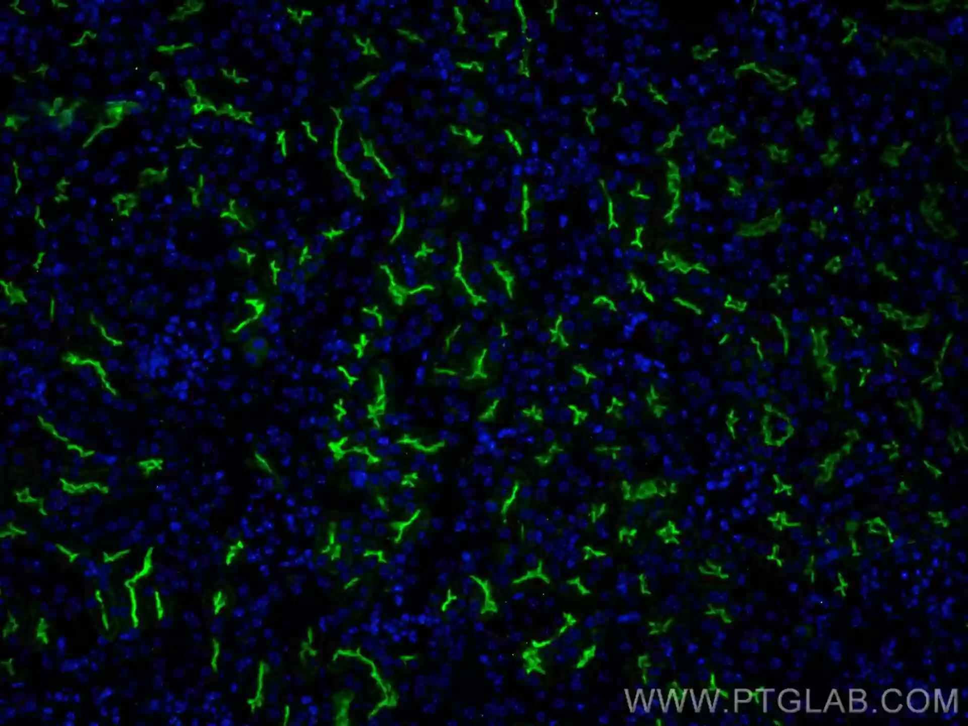 CD133 antibody (18470-1-AP) | Proteintech