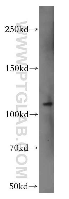 CD133 antibody (18470-1-AP) | Proteintech