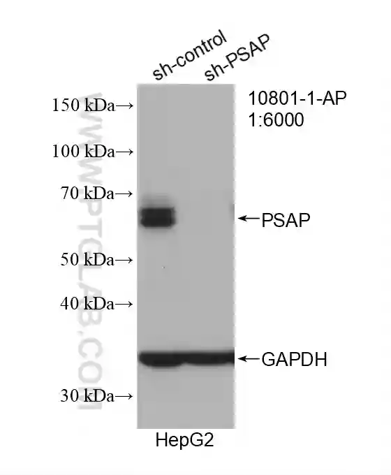 PSAP antibody (10801-1-AP) | Proteintech