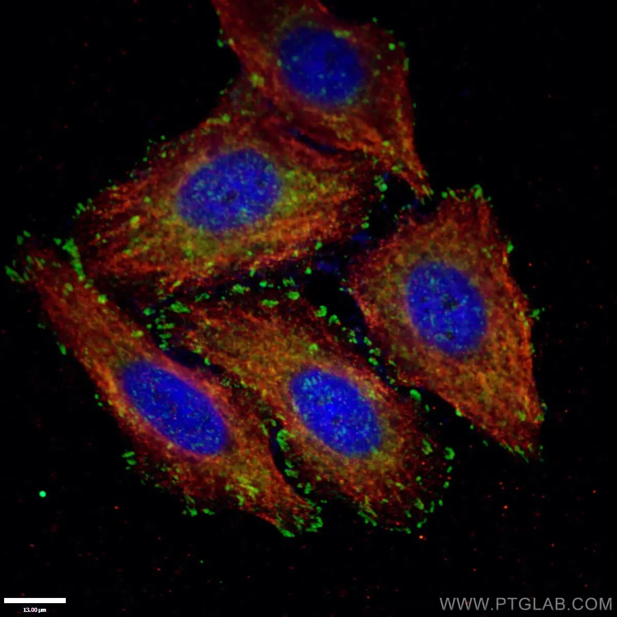 Immunofluorescent (IF) Paxillin Antibody staining with HepG2 cells