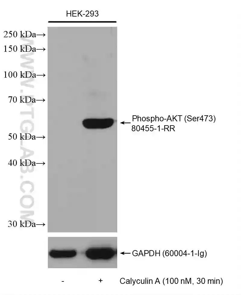 Western blot analysis of HEK-293 using Phospho-AKT (Ser473) Recombinant antibody