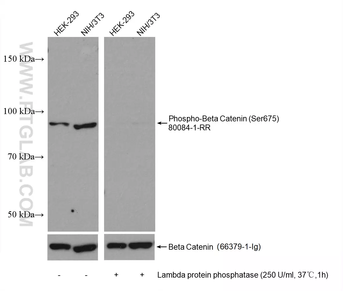 Phospho-Beta Catenin (Ser675) antibody (80084-1-RR) | Proteintech