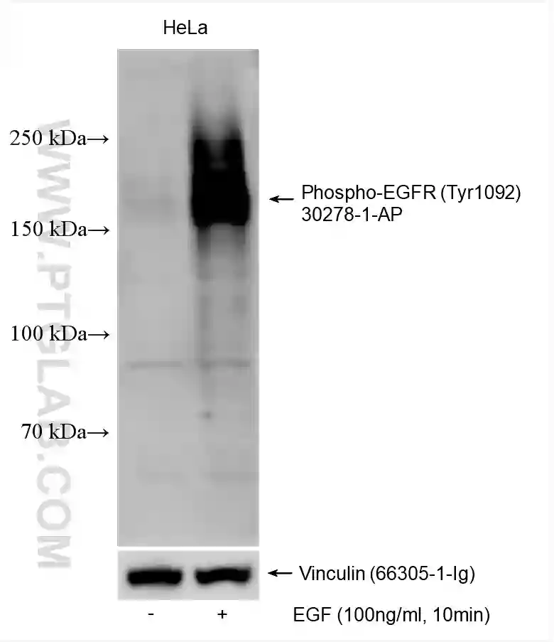 Phospho EGFR Tyr1092 antibody 30278 1 AP Proteintech