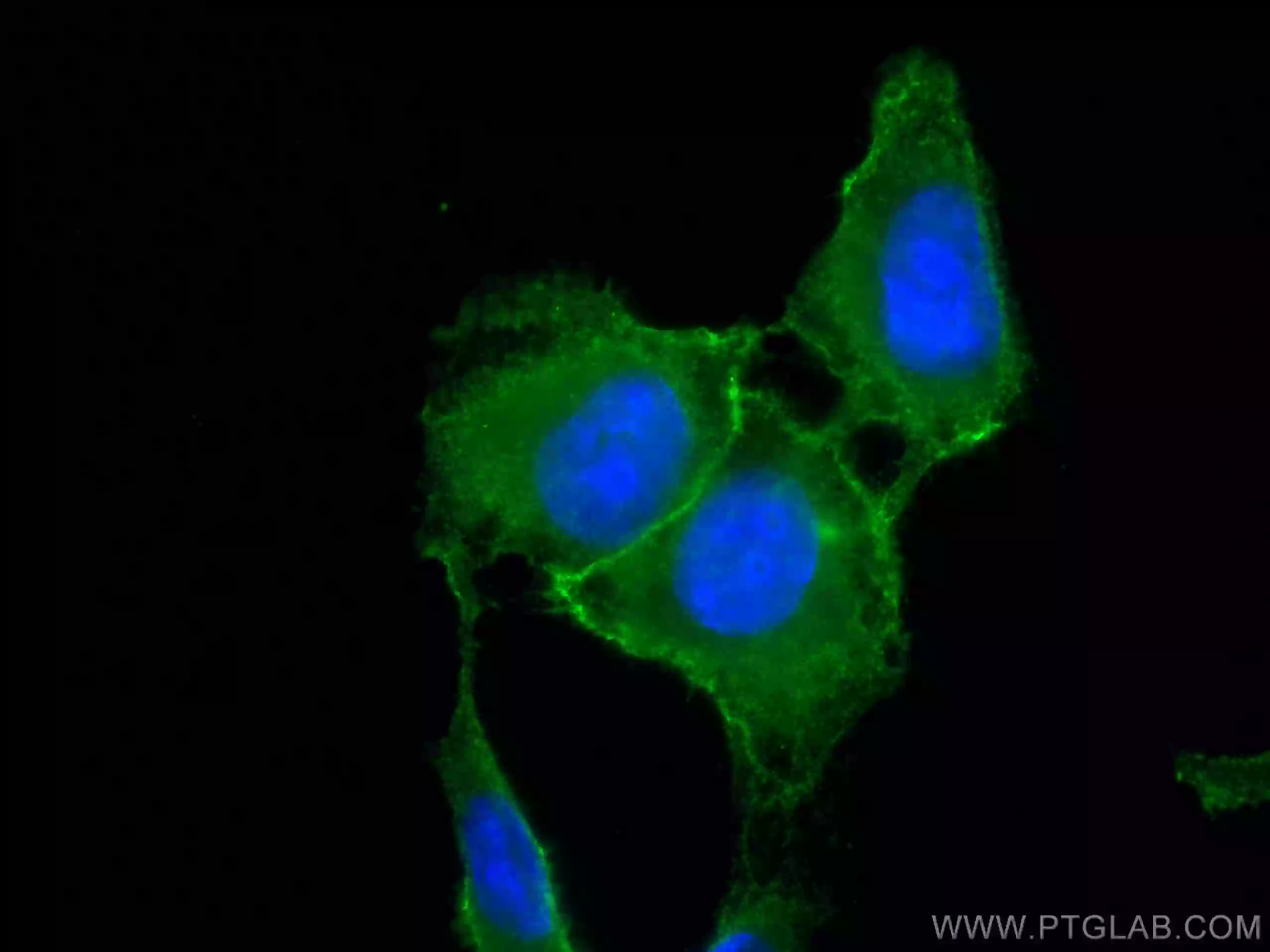 Phospho-RIPK1 (Ser161) antibody (CL488-66854) | Proteintech