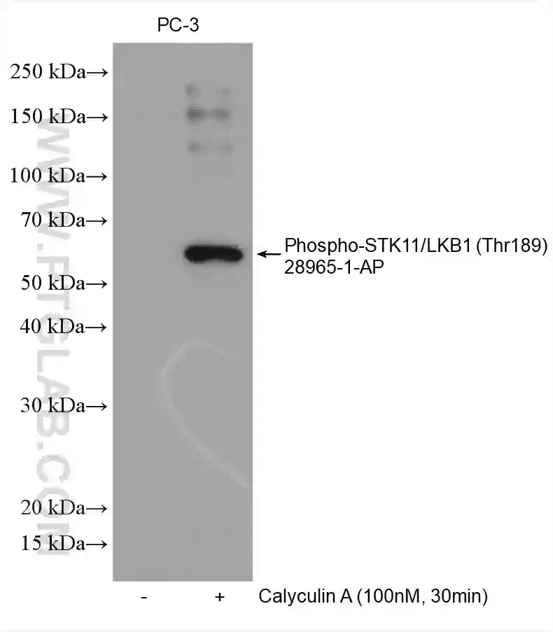 Phospho-STK11/LKB1 (Thr189) antibody (28965-1-AP) | Proteintech