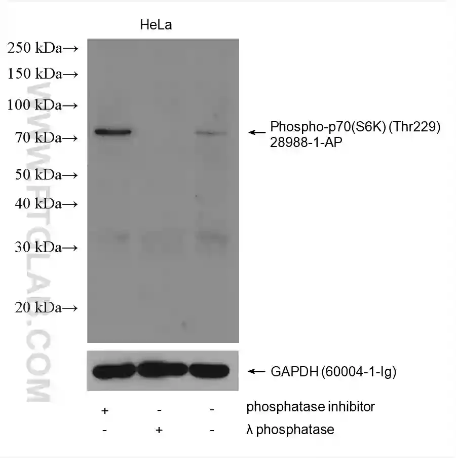 Phospho-p70(S6K) (Thr229) antibody (28988-1-AP) | Proteintech