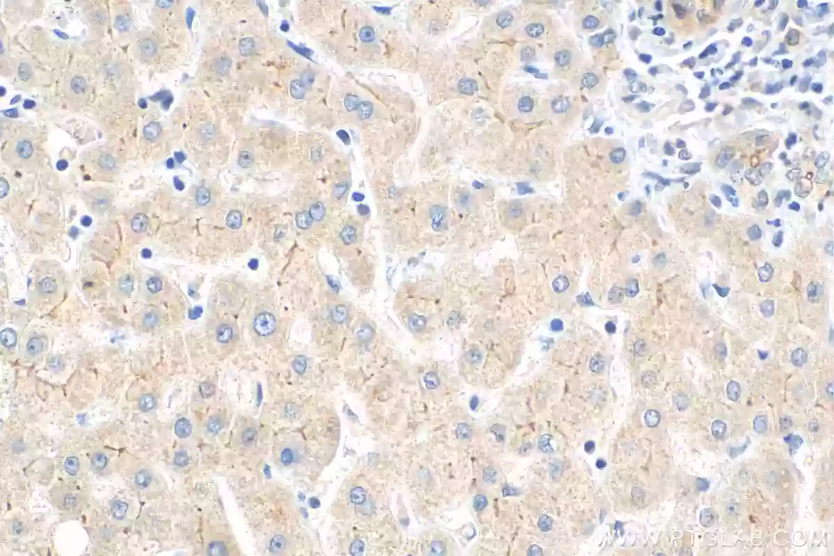 Piezo2 antibody (26205-1-AP) | Proteintech